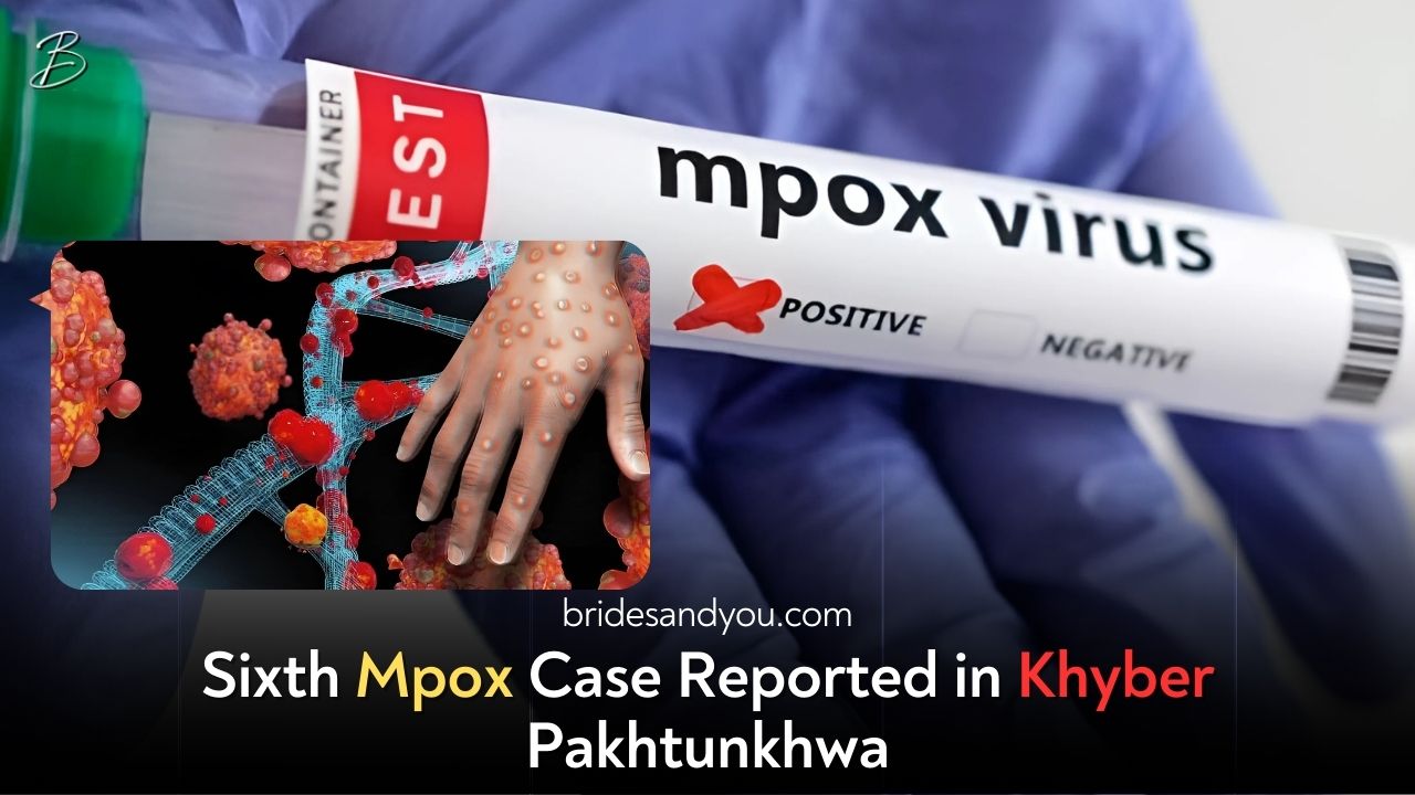 Sixth Mpox Case Confirmed in Khyber-Pakhtunkhwa: A Wake-Up Call for Better Health Measures