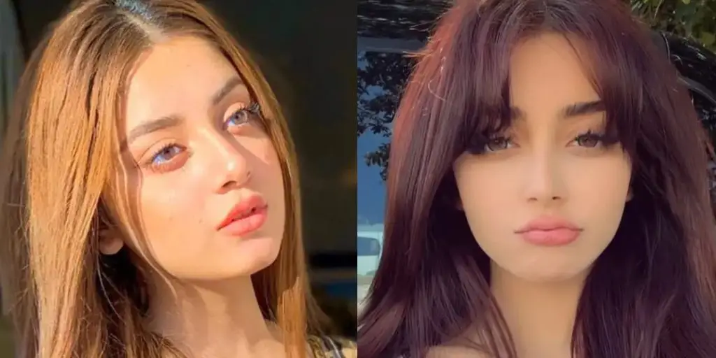 Alizeh Shah denies plastic surgery rumors