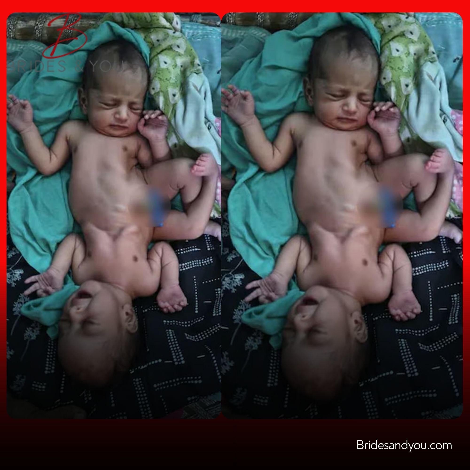Rare Birth